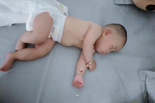 国内两个月三代代生孩子脐疝怎么办